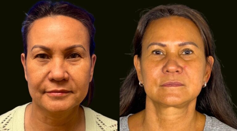 Sanam Zahedi, MD - Zahedi Plastic Surgery provider photo