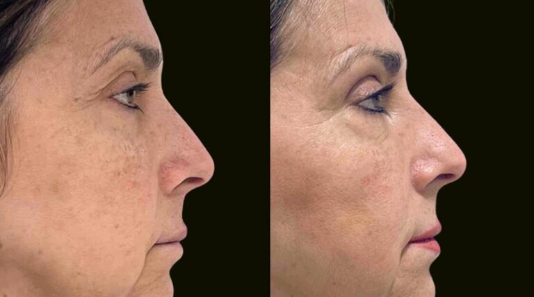 Sanam Zahedi, MD - Zahedi Plastic Surgery provider photo