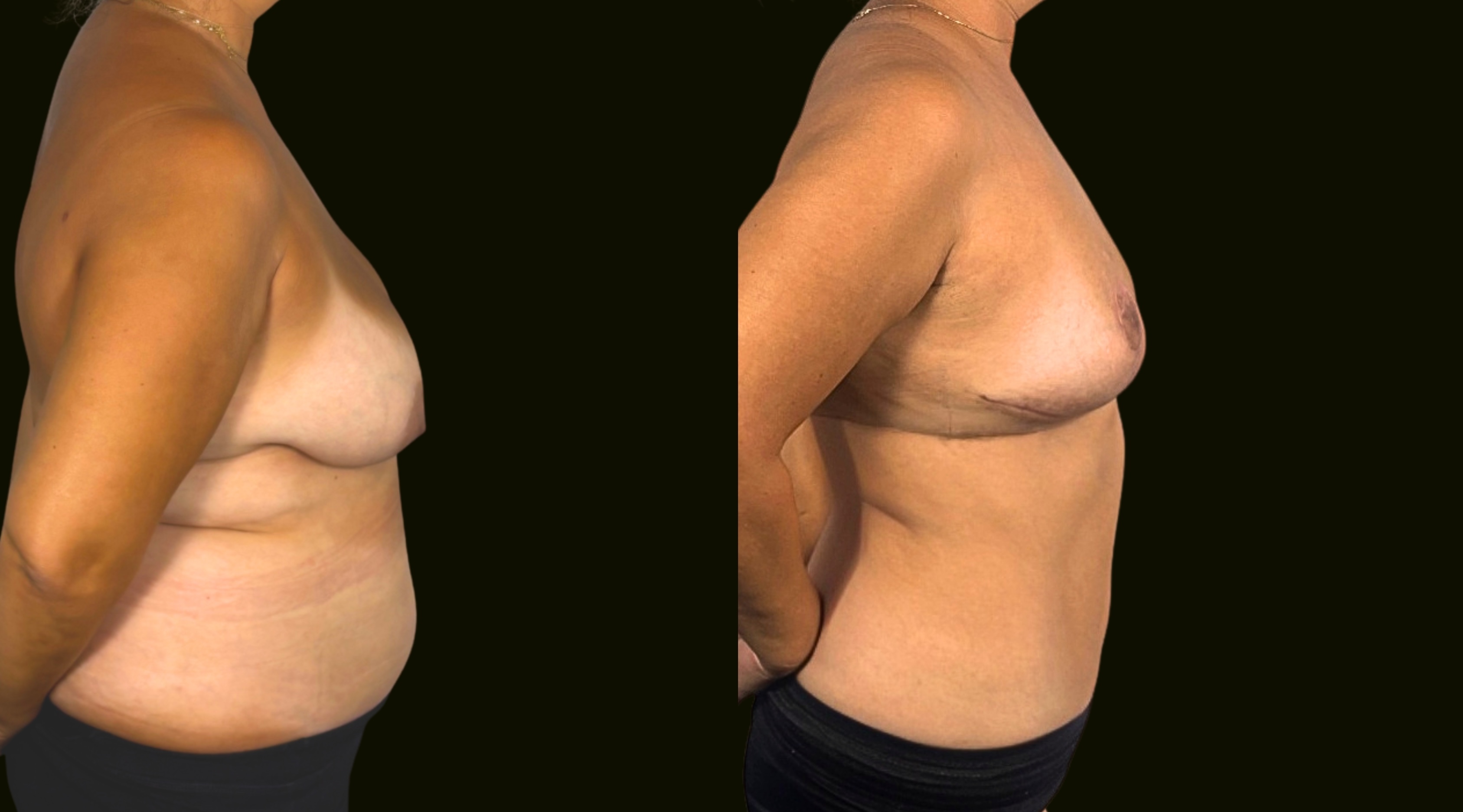 Sanam Zahedi, MD - Zahedi Plastic Surgery provider photo