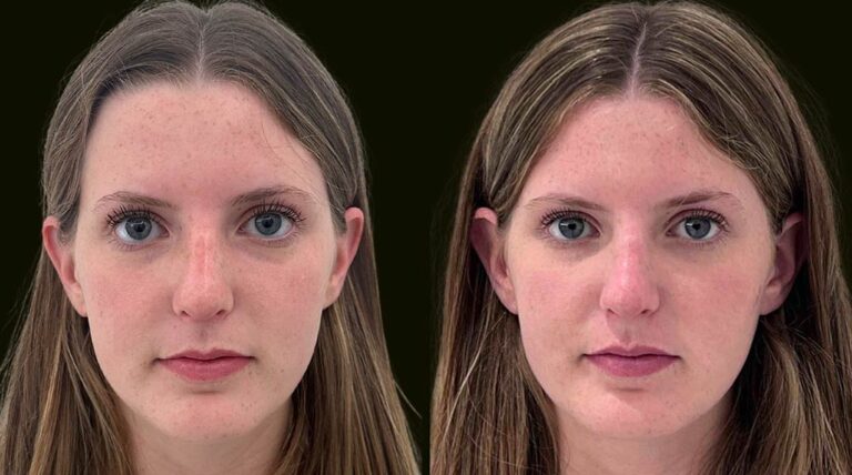 Sanam Zahedi, MD - Zahedi Plastic Surgery provider photo
