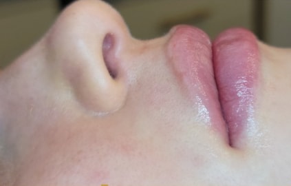 A result from Renewal Aesthetics and Sexual Wellness