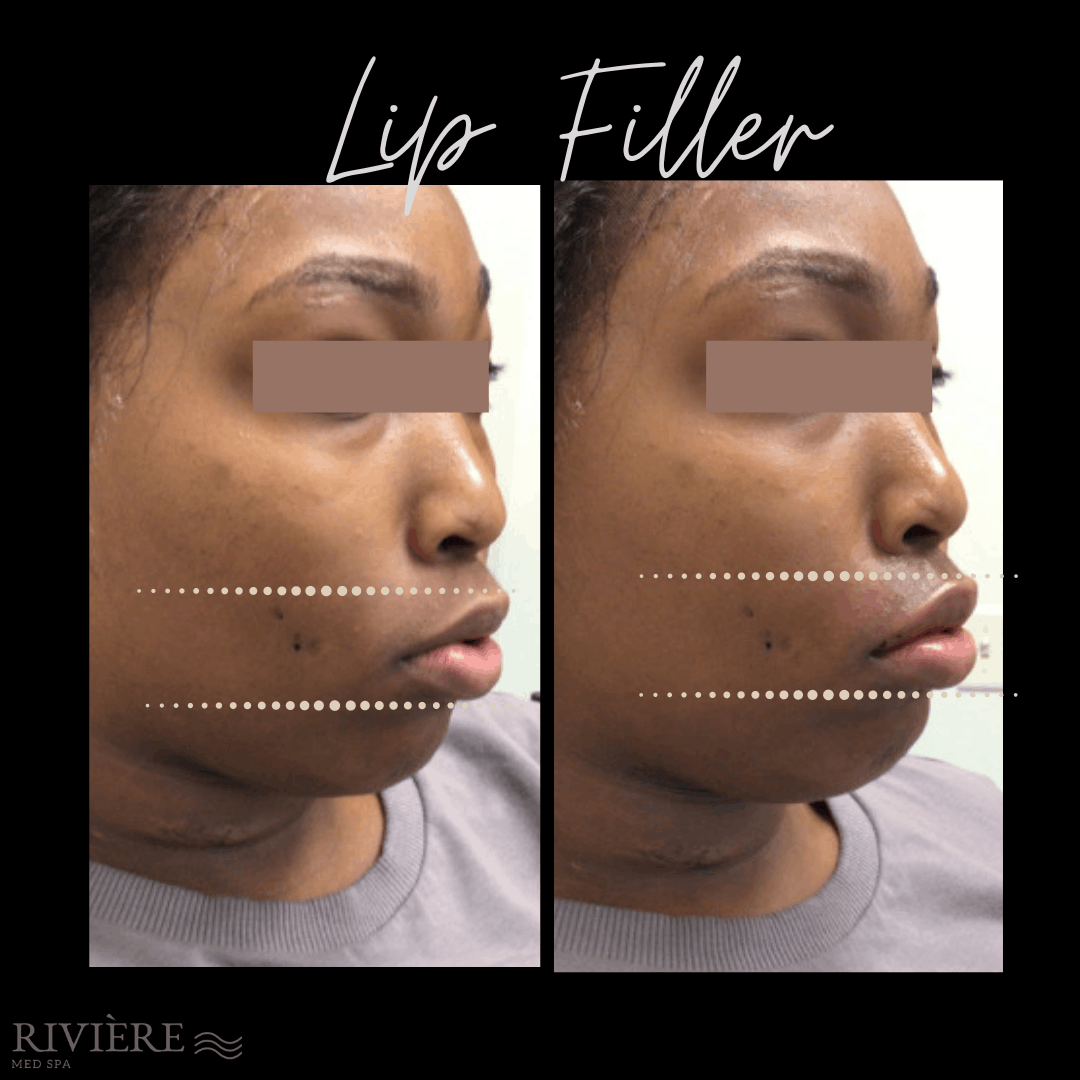 A result from Rivière Med Spa