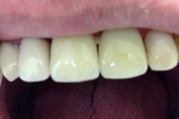 A result from Birch Dental