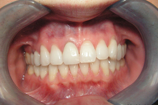 A result from Birch Dental