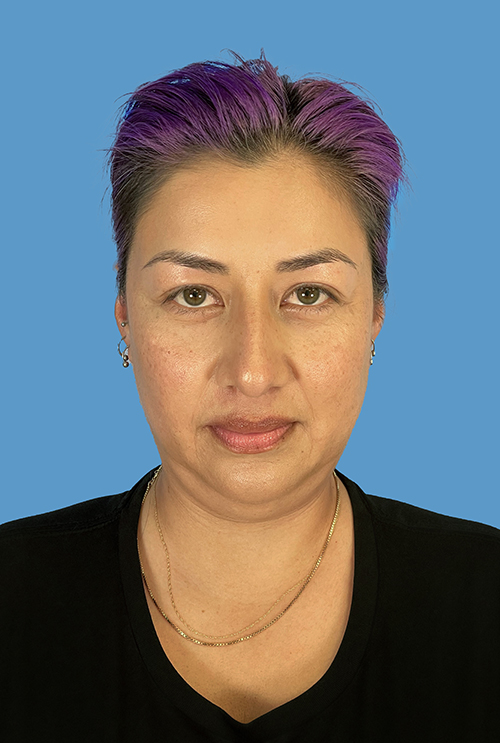 Liposuction before photo