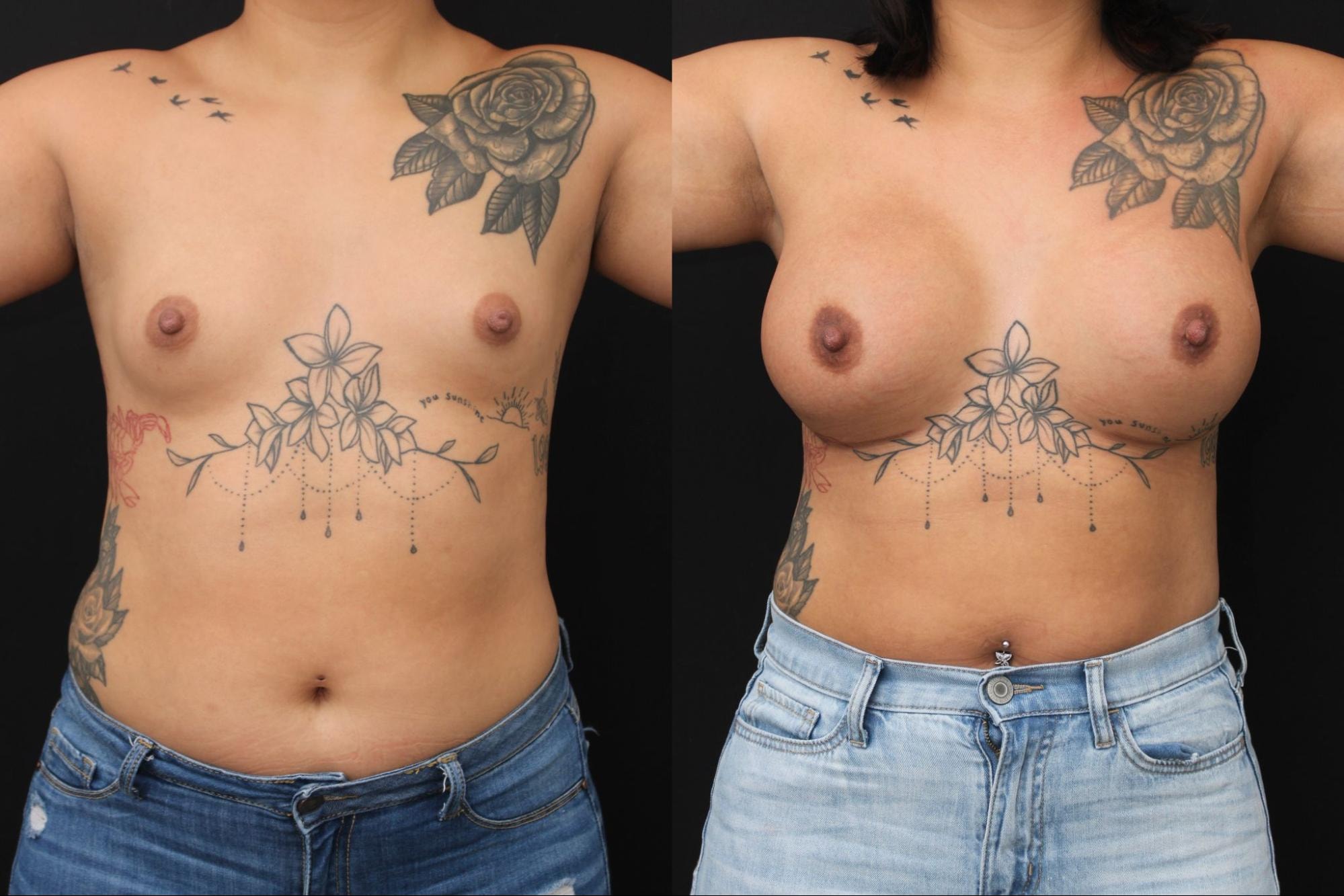 A result from Chernoff Cosmetic Surgery