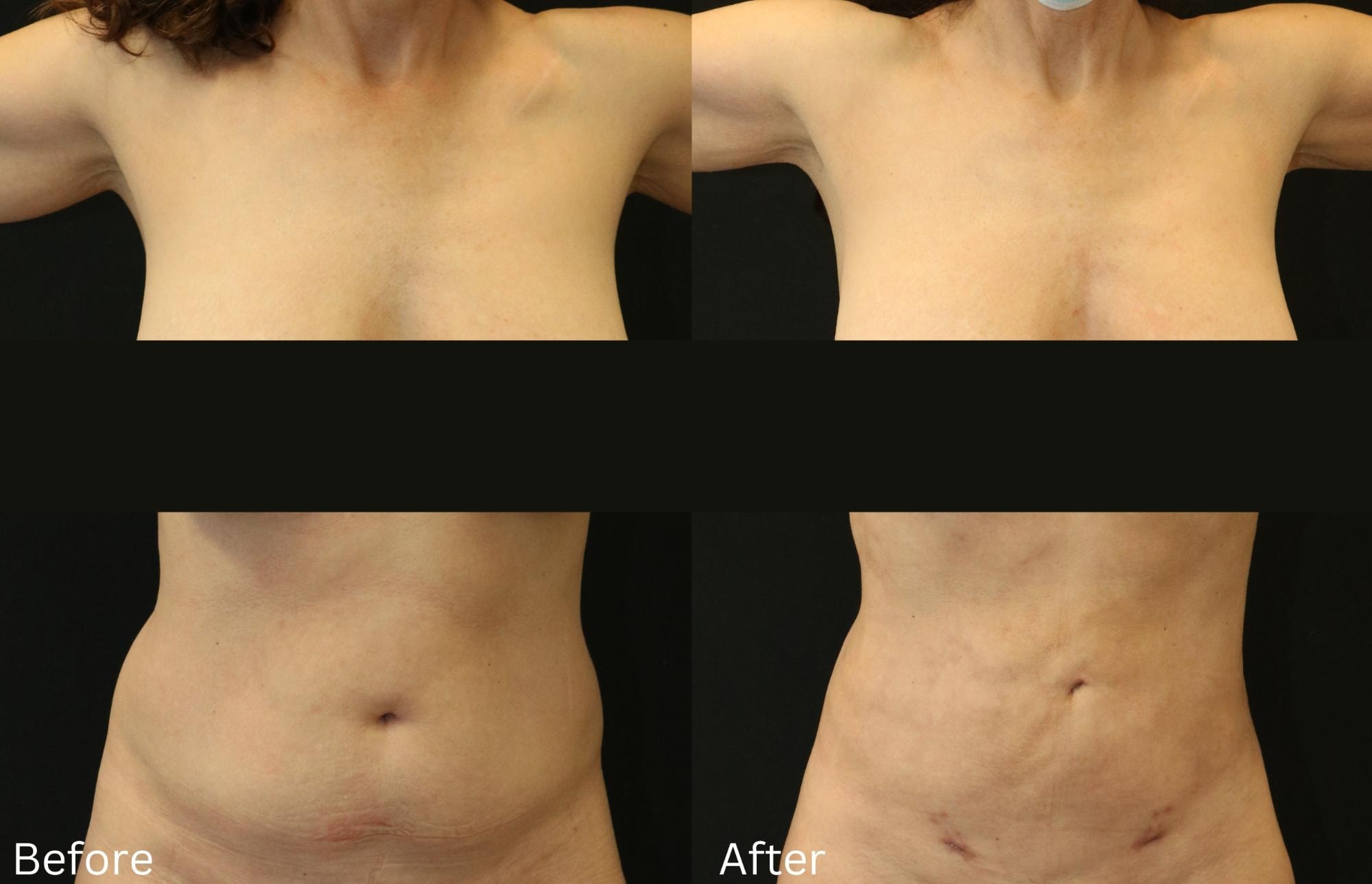 A result from Chernoff Cosmetic Surgery