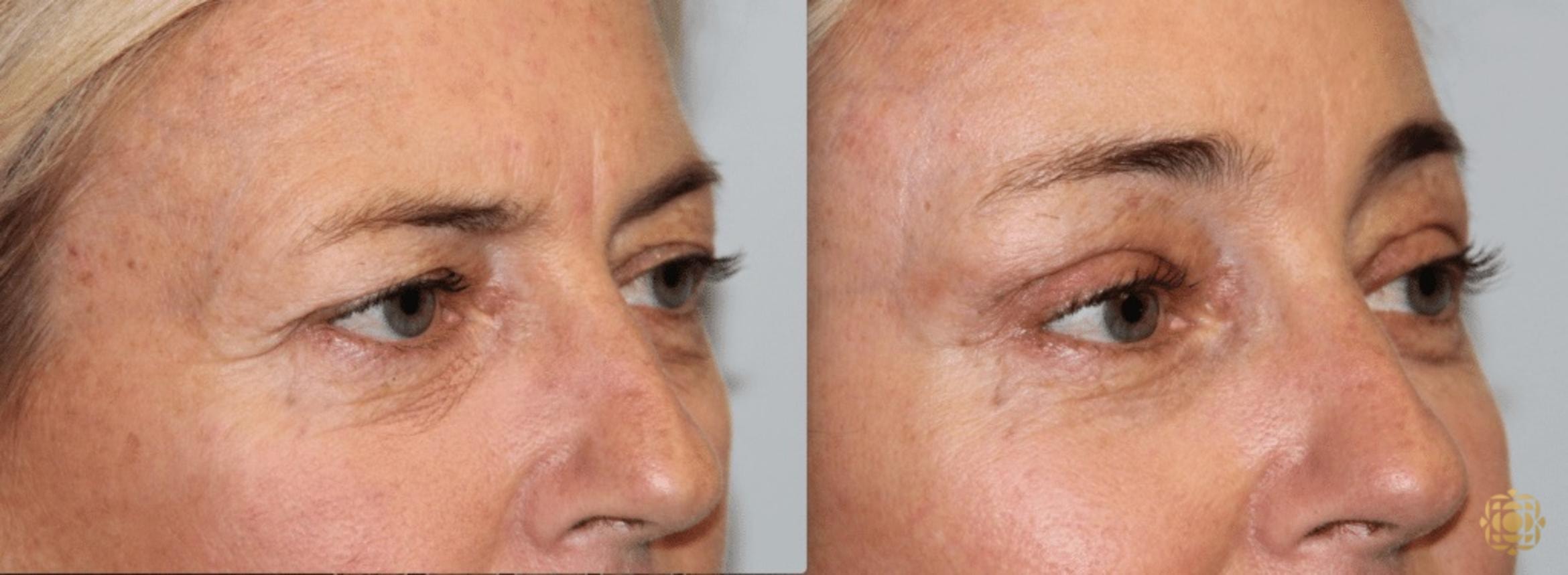 A result from Daines Plastic Surgery: Steven M. Daines, MD FACS