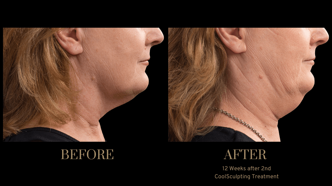 A result from PURE Medical Spa