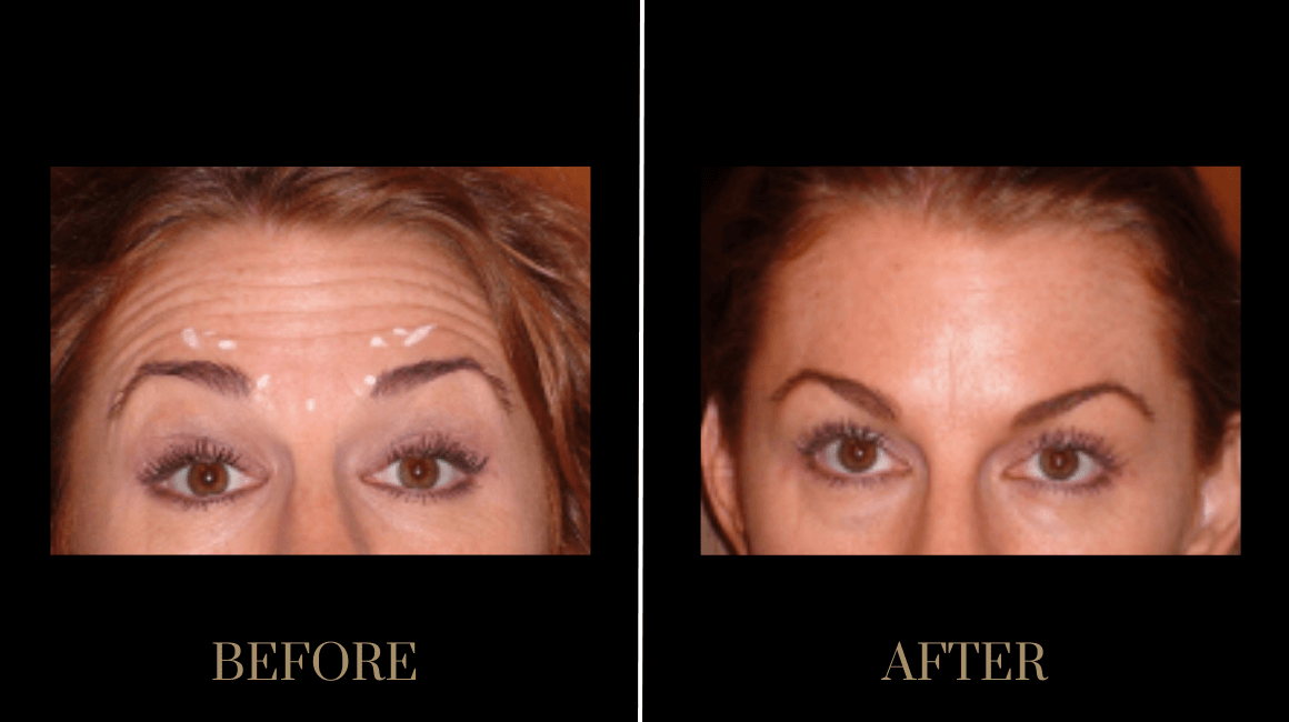 A result from PURE Medical Spa