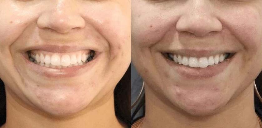 A result from Brickell Cosmetic Center