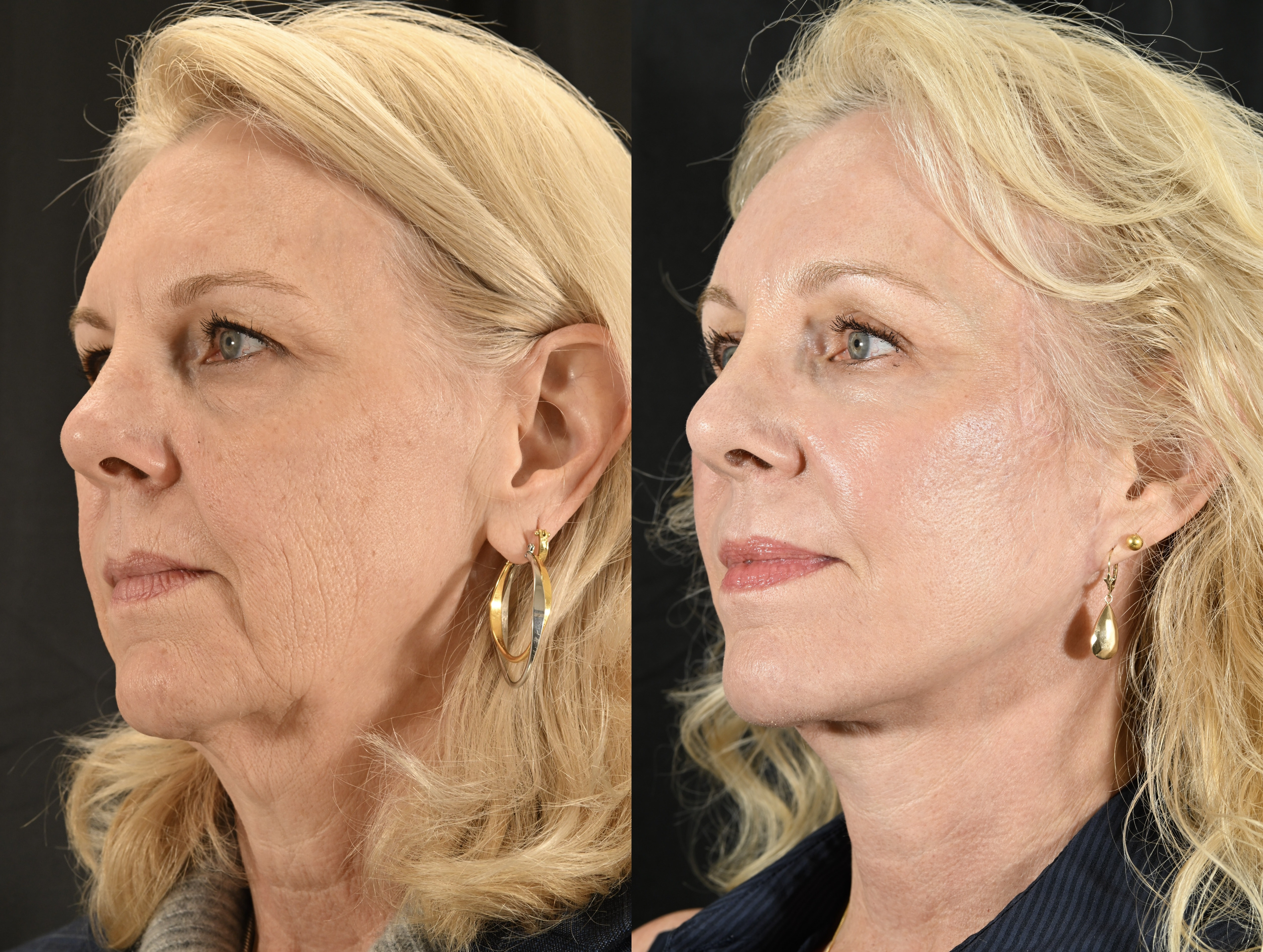 A result from Jesse E Smith, MD, FACS