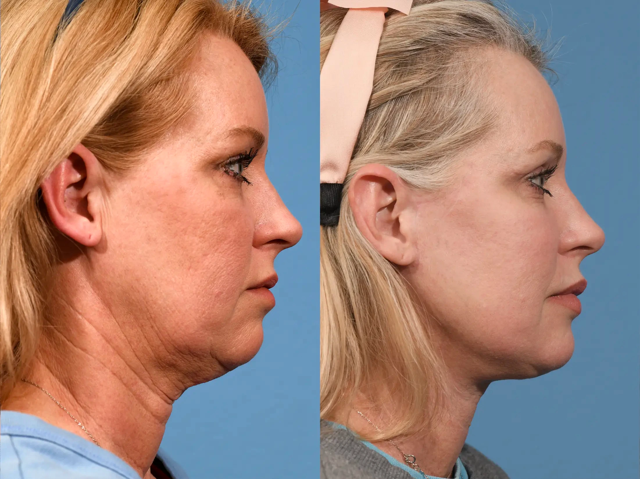 A result from Jesse E Smith, MD, FACS