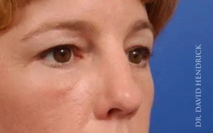 Millard Plastic Surgery provider photo