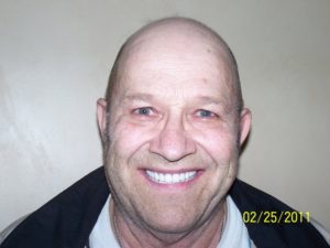 Red Cliffs Dental veneers after — St. George, UT
