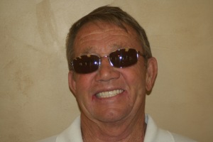 Red Cliffs Dental veneers after — St. George, UT