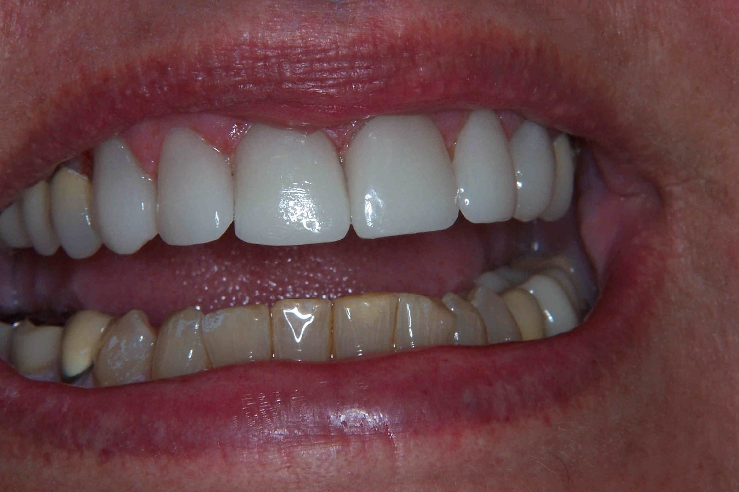 A result from Newport Beach Dental Solutions