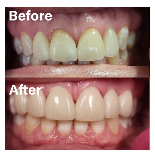 A result from Common Sense Family Dentistry