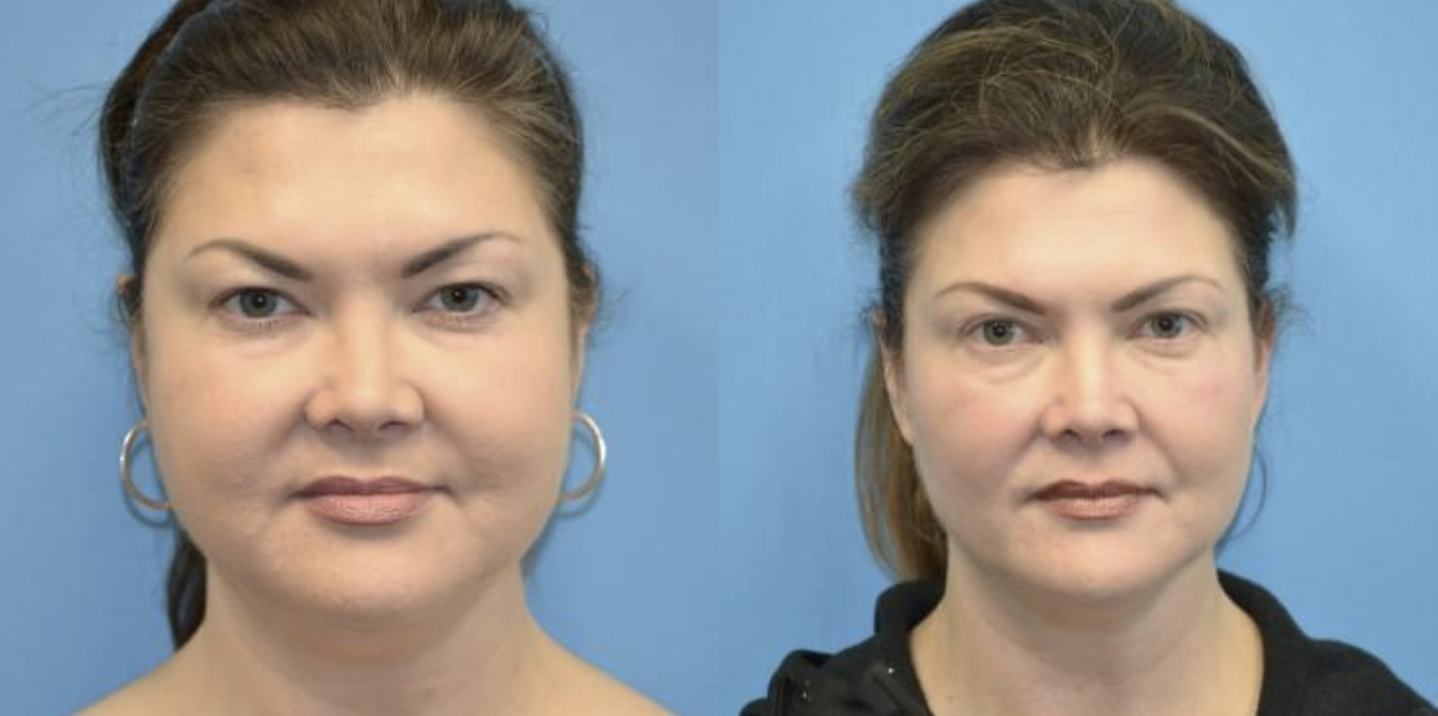 West End Facial Plastic Surgery provider photo
