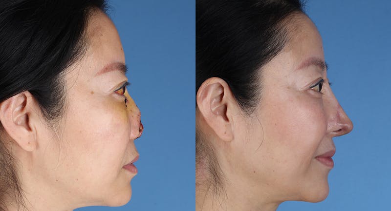 Andre Panossian, MD, Plastic Surgery provider photo