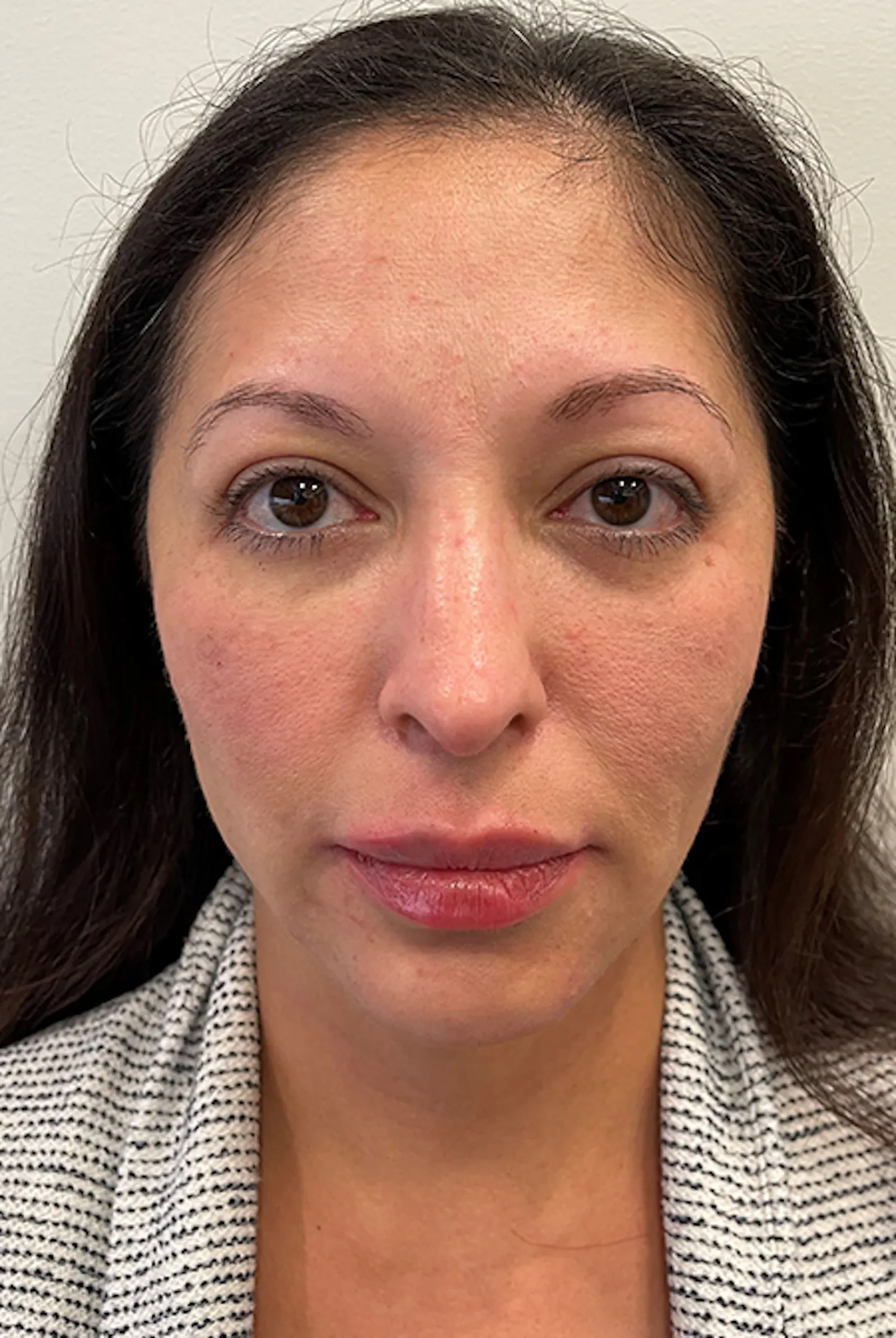A result from Marcus Medical