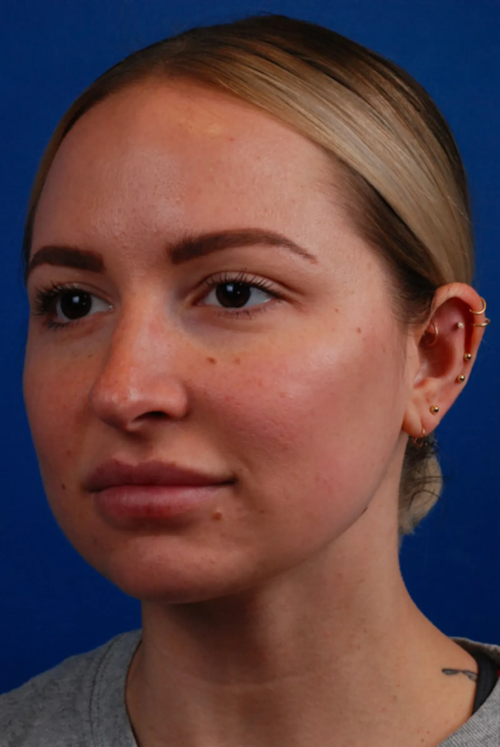 A result from Marcus Medical