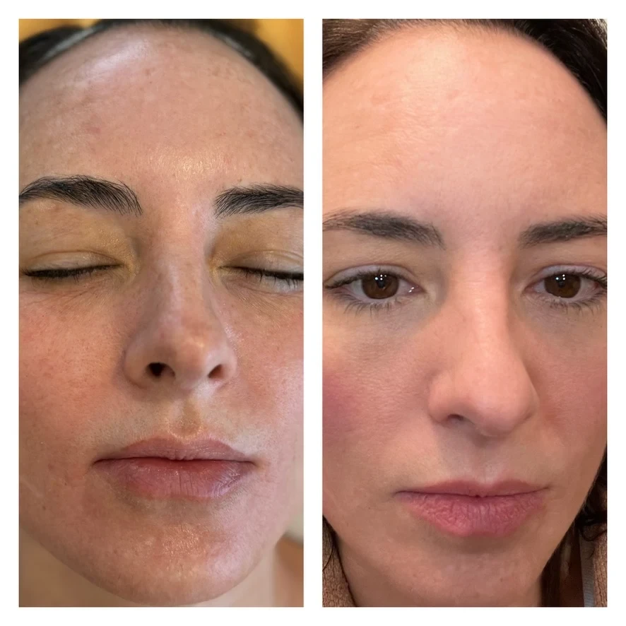 A result from Novu Wellness & Aesthetics