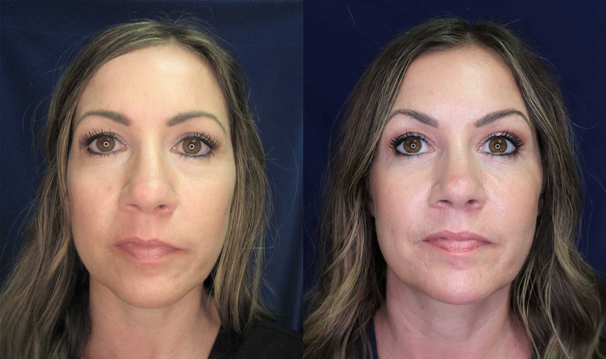 Arkansas Plastic Surgery provider photo