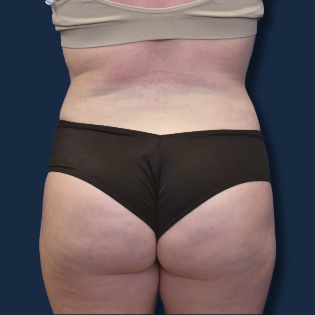 A result from The Surgeonista - Gina Maccarone MD, FACS