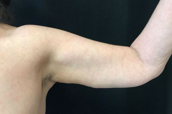 A result from The Institute of Cosmetic Surgery