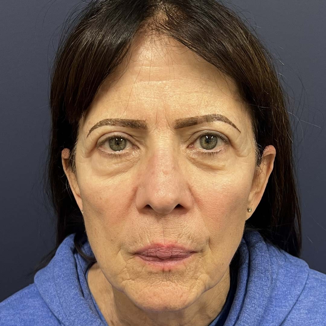 A result from Burt & Will Plastic Surgery and Dermatology