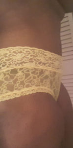 A result from Port City Plastic Surgery - Charleston