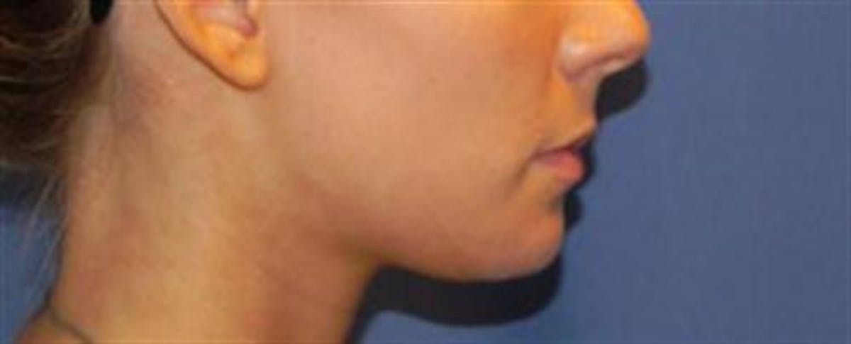 A result from Basu Plastic Surgery