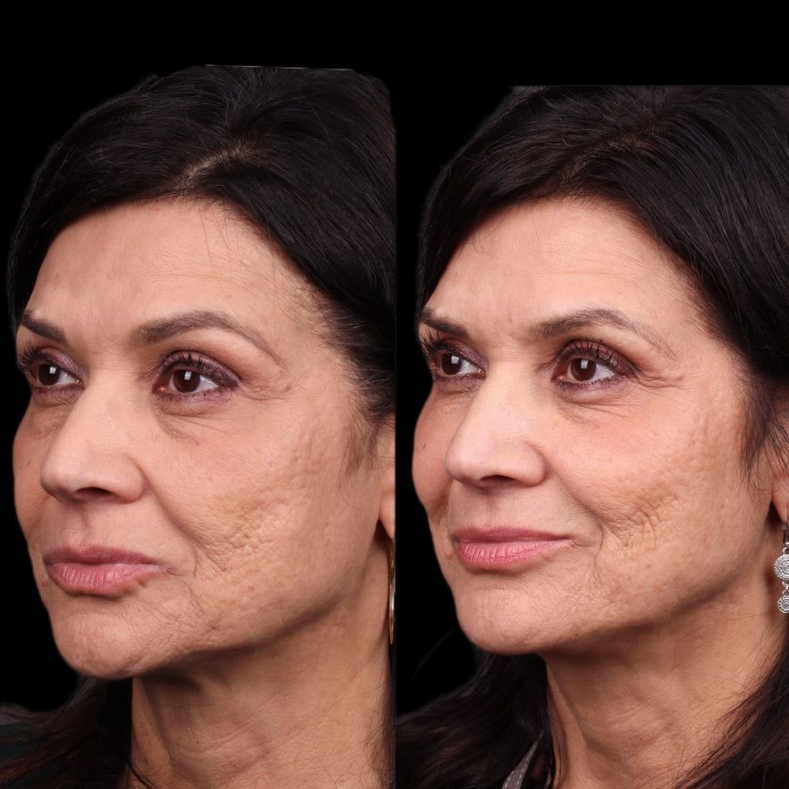 A result from Coastline Plastic Surgery