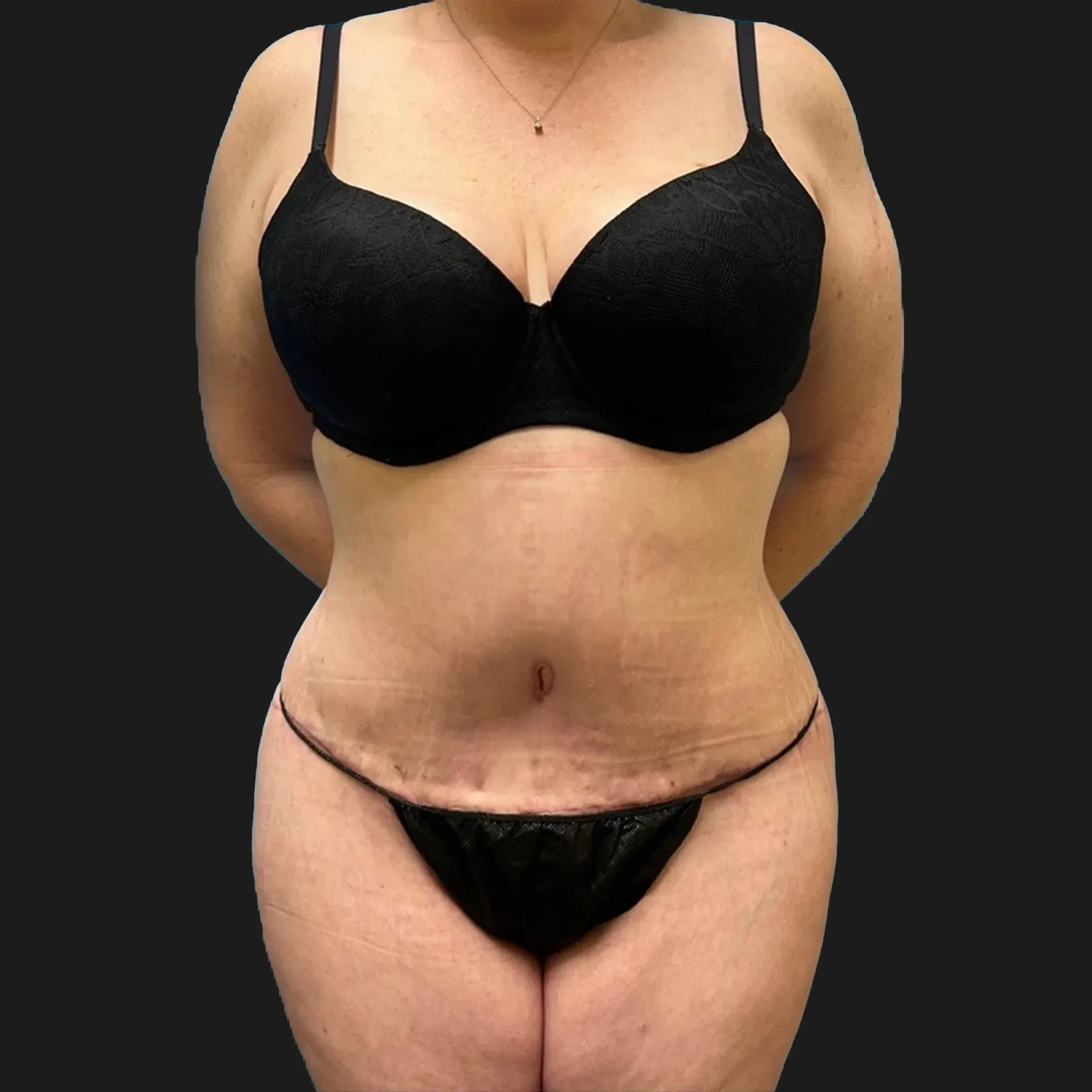 A result from Aesthetx