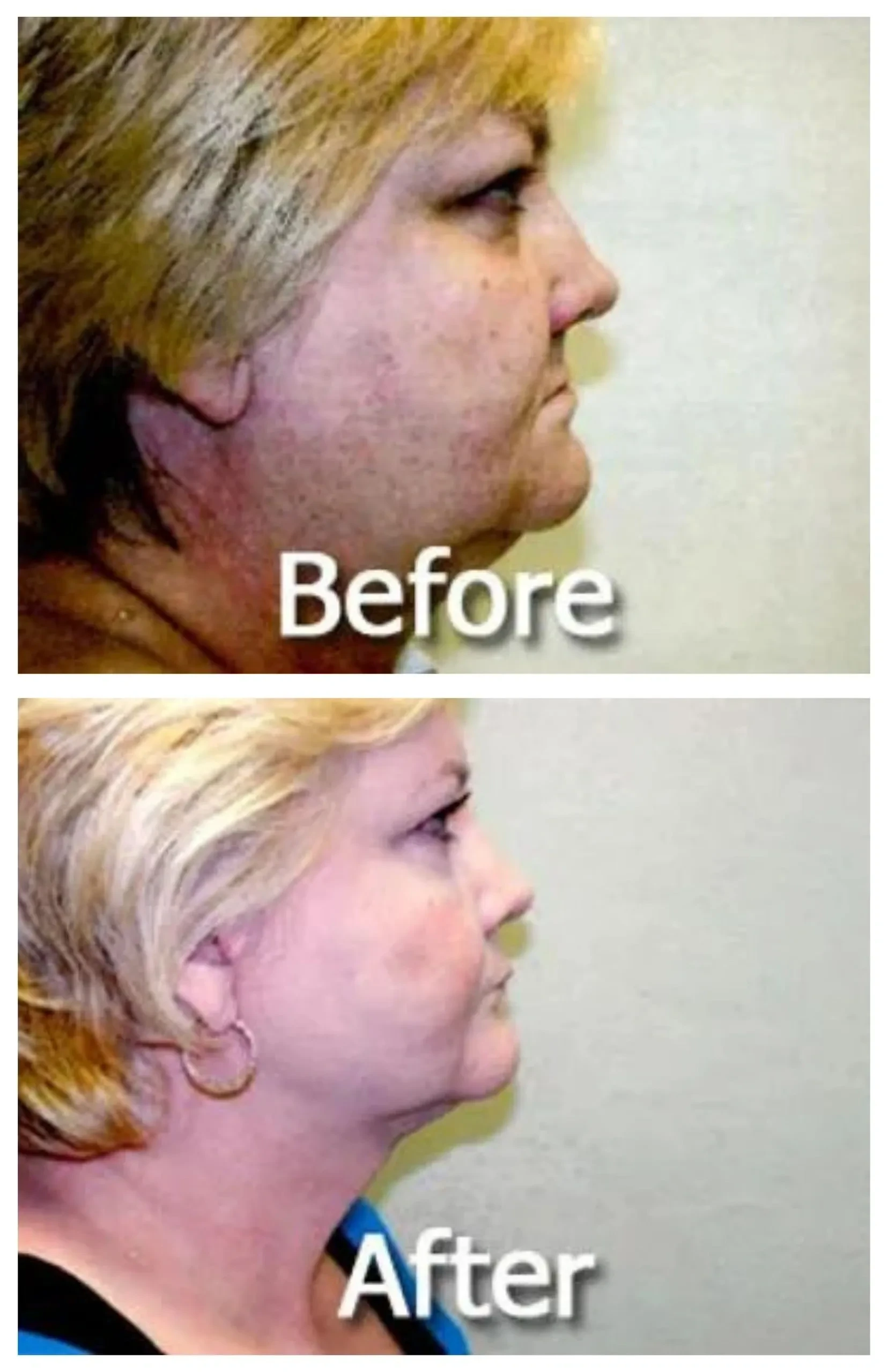 A result from Image Cosmetic Surgery Center