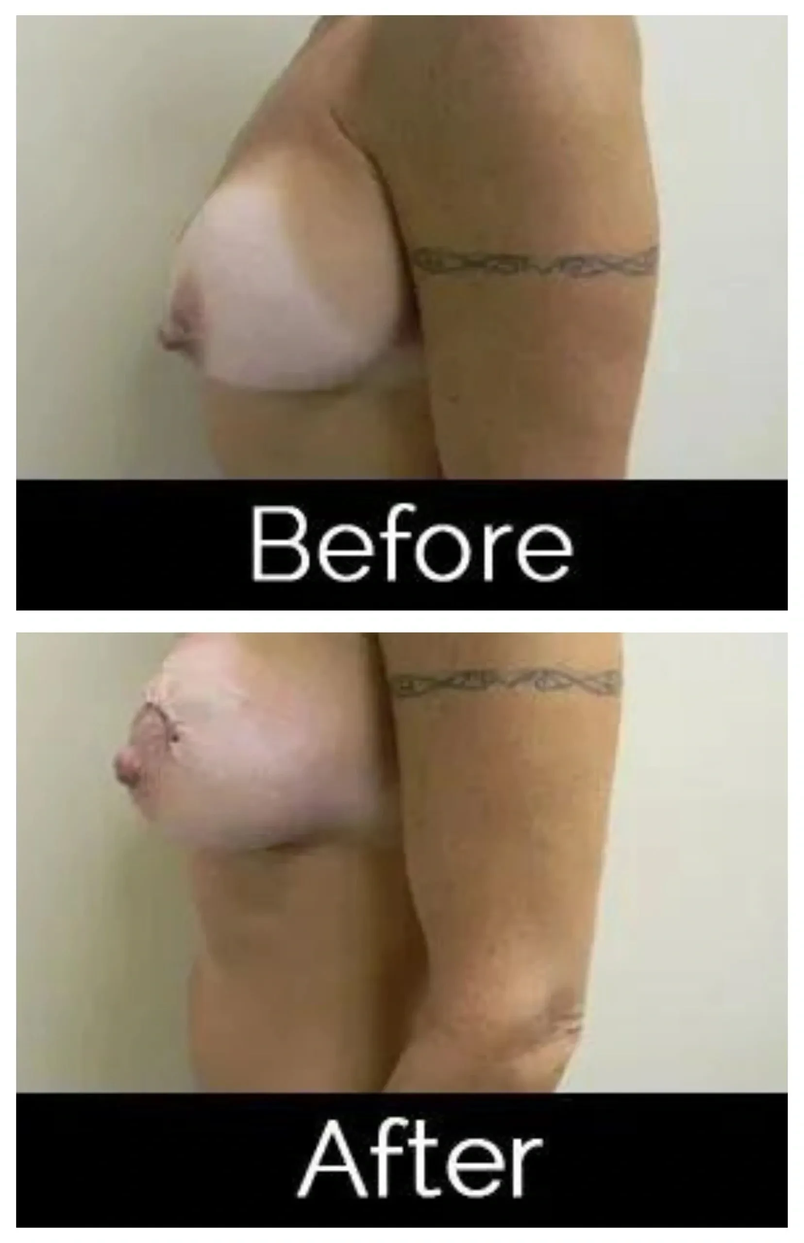 A result from Image Cosmetic Surgery Center
