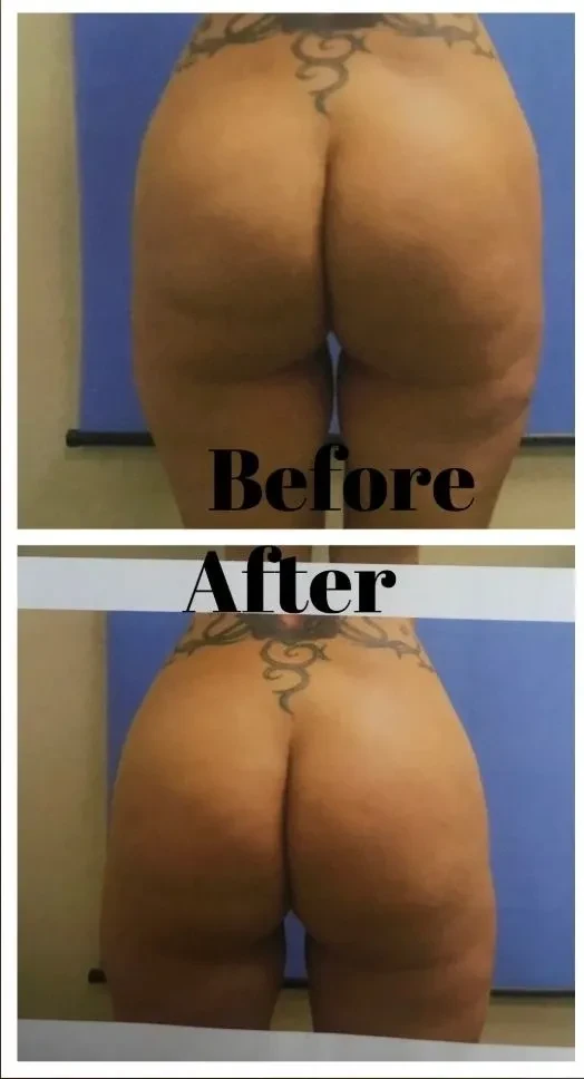 A result from Image Cosmetic Surgery Center