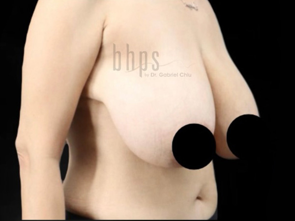 Procedure before photo