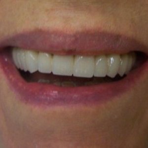 A result from DV Dentistry