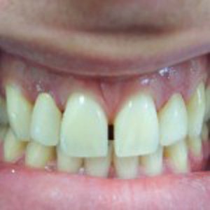 A result from DV Dentistry