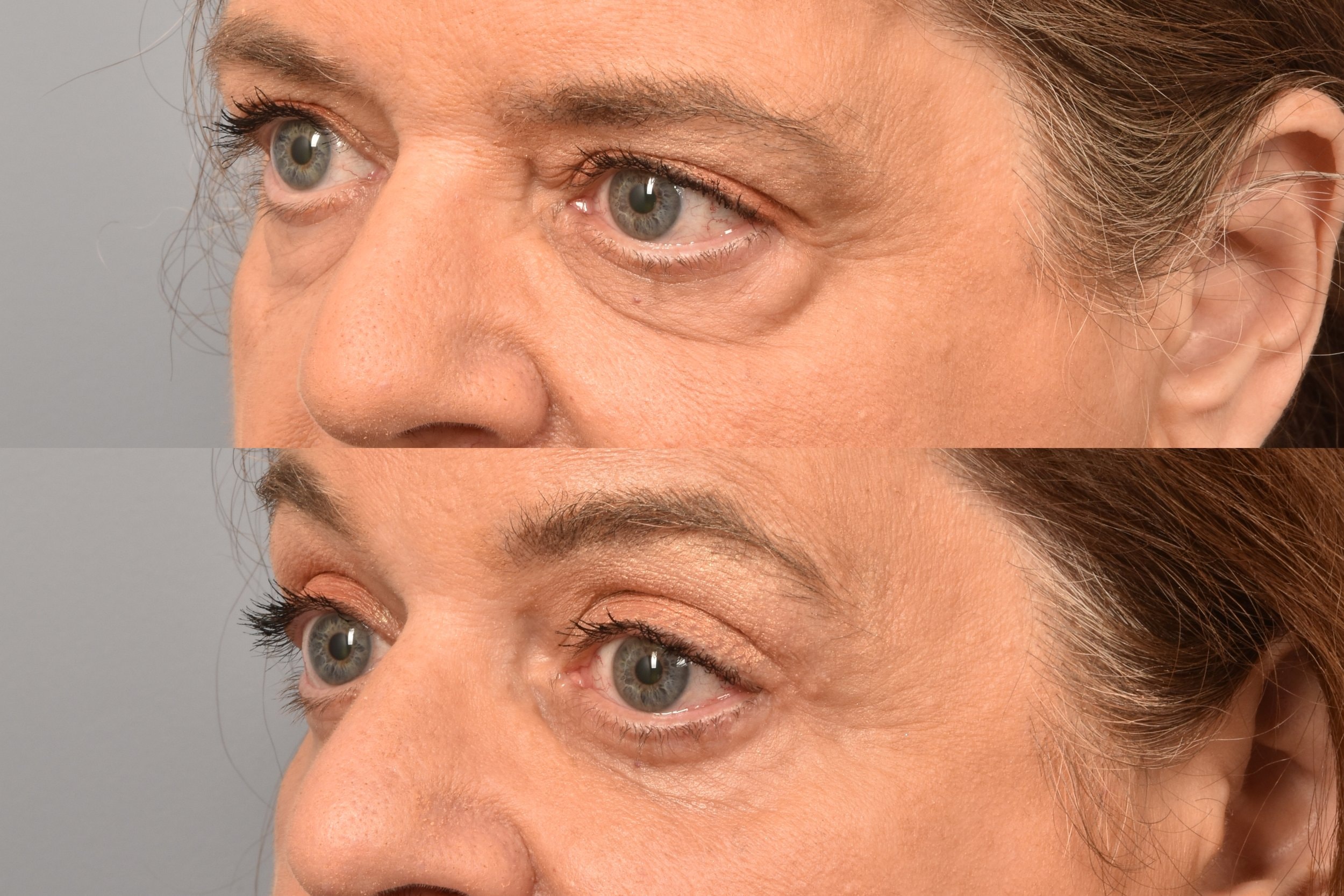 A result from Meryam Shikara, MD