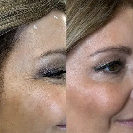 Monroe MedSpa - Buffalo provider photo