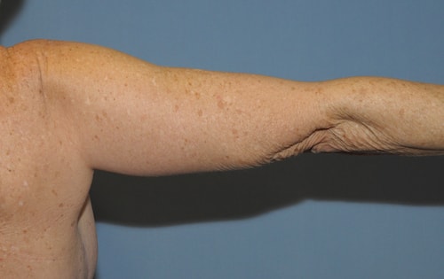 A result from Dr. Robert G Bonillas MD
