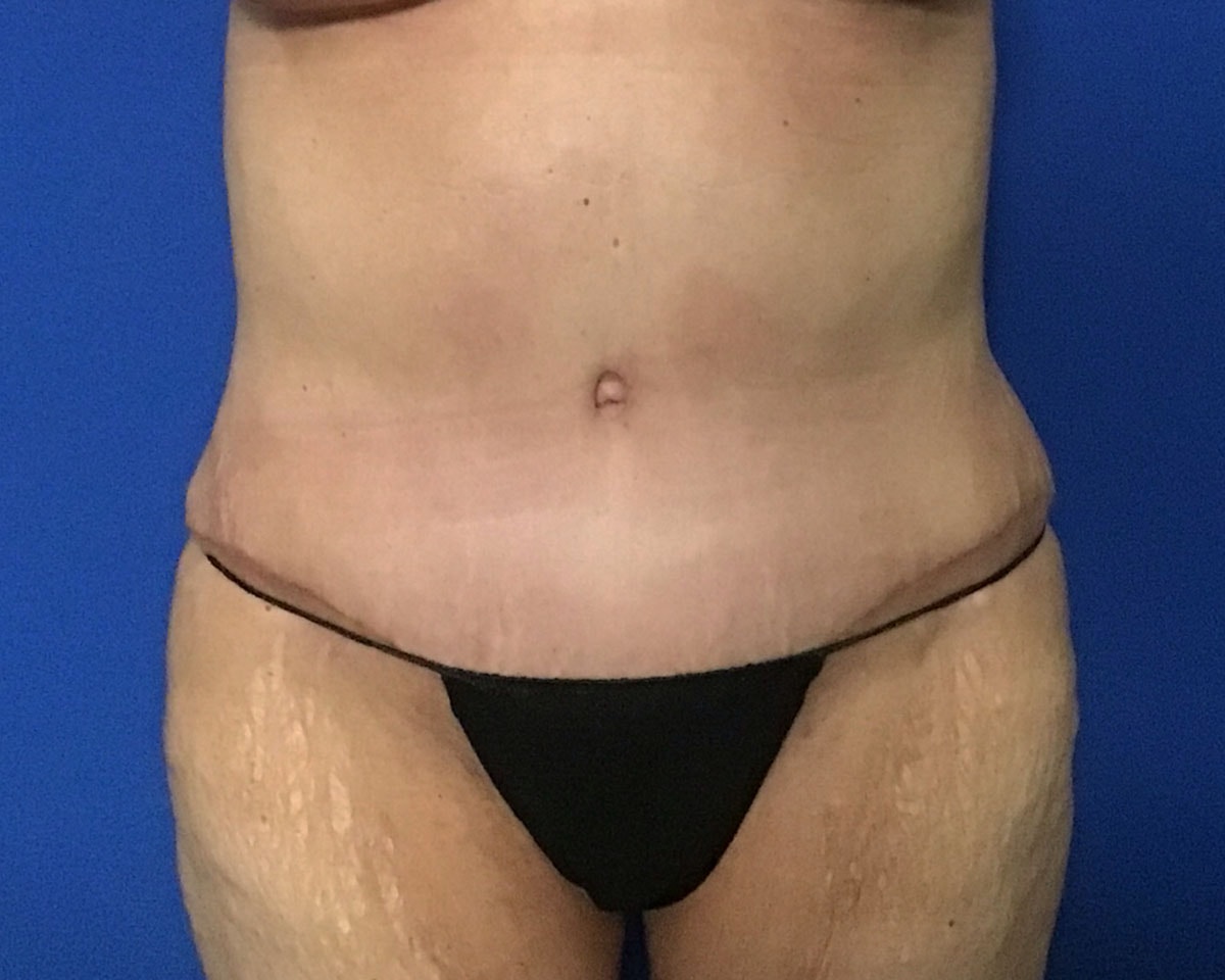 A result from Aura Boulder