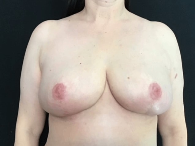 A result from Aura Boulder