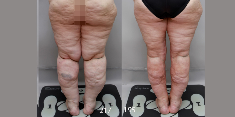 Ditesheim Cosmetic Surgery provider photo