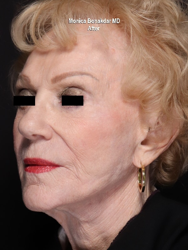 A result from Bonakdar Aesthetics
