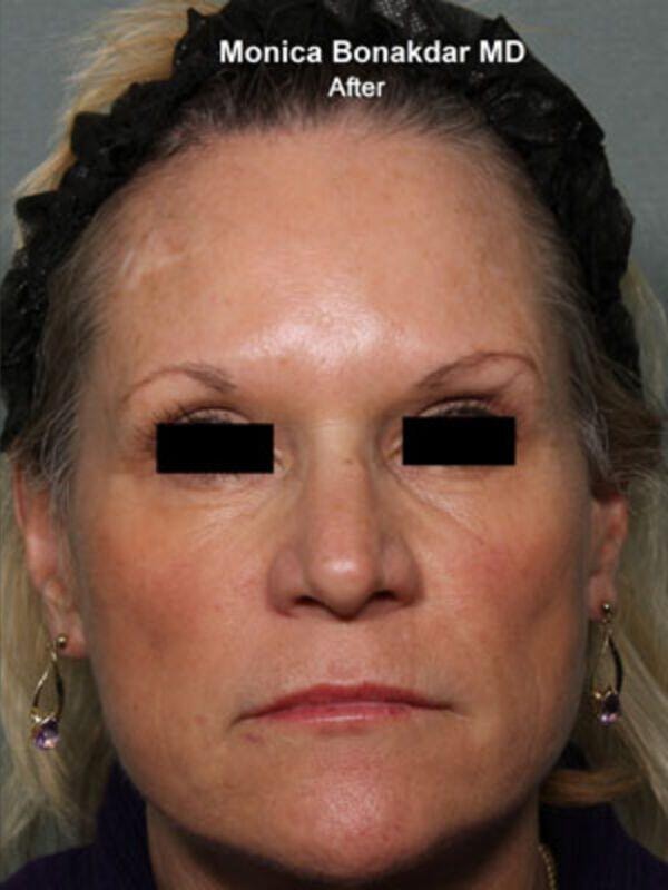 A result from Bonakdar Aesthetics