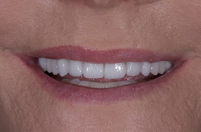 A result from Libby Dental